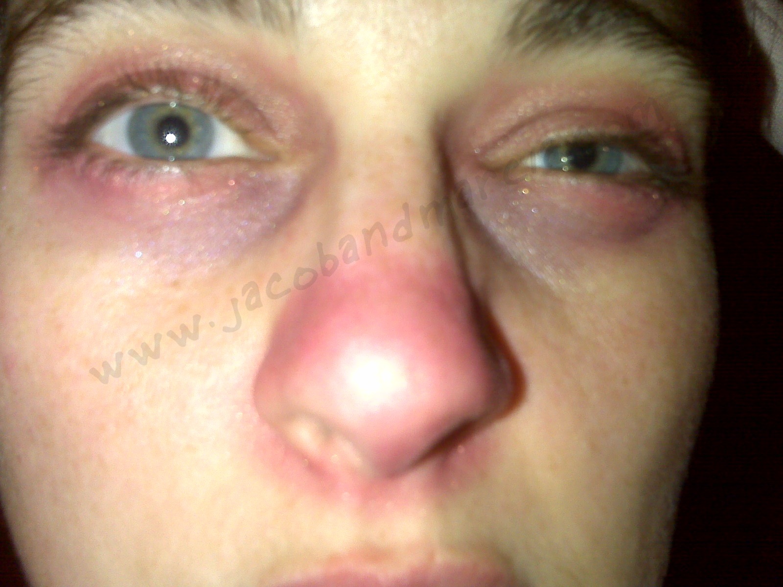 myeyes